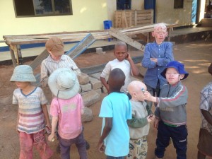 albino children biggenheimer