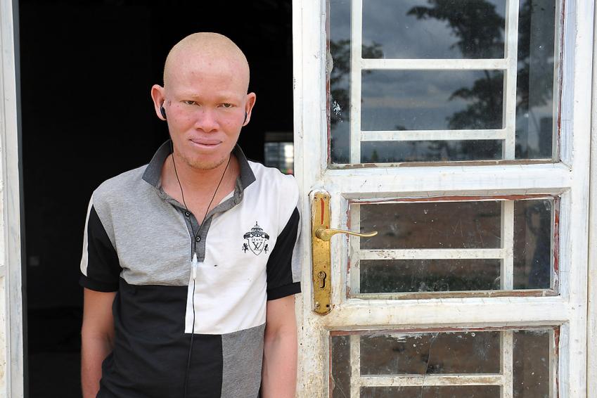 Lutheran Bishop in Tanzania speaks up against the persecution of people with albinism