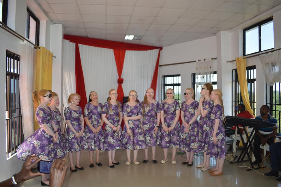 Graduation for albino women