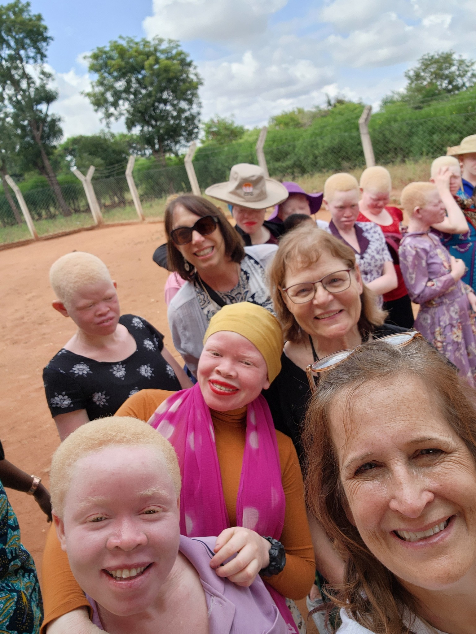 Lutheran Women’s Missionary League grant funds home for albino women